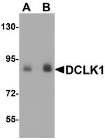 DCLK1 Antibody in Western Blot (WB)