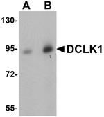 DCLK1 Antibody in Western Blot (WB)