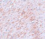 DCAMKL2 Antibody in Immunohistochemistry (IHC)