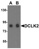 DCAMKL2 Antibody in Western Blot (WB)