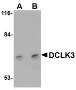 DCLK3 Antibody in Western Blot (WB)