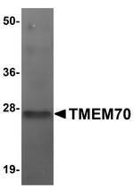 TMEM70 Antibody in Western Blot (WB)