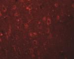 EFHD2 Antibody in Immunohistochemistry (IHC)