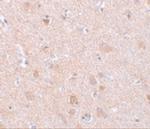 EFHD2 Antibody in Immunohistochemistry (IHC)