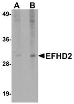 EFHD2 Antibody in Western Blot (WB)