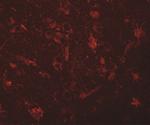 ZC3H12C Antibody in Immunohistochemistry (IHC)