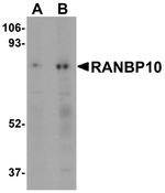 RANBP10 Antibody in Western Blot (WB)