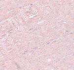 ADAMTSL5 Antibody in Immunohistochemistry (IHC)