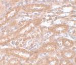 ENC1 Antibody in Immunohistochemistry (IHC)