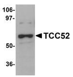 DCAF12 Antibody in Western Blot (WB)