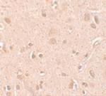 NSA2 Antibody in Immunohistochemistry (IHC)