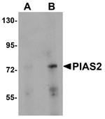 PIAS2 Antibody in Western Blot (WB)