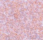 CtIP Antibody in Immunohistochemistry (IHC)