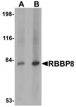 CtIP Antibody in Western Blot (WB)