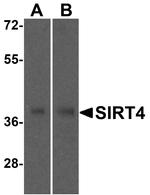 SIRT4 Antibody in Western Blot (WB)