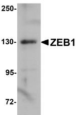 ZEB1 Antibody in Western Blot (WB)