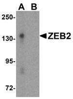 ZEB2 Antibody in Western Blot (WB)