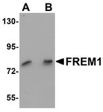 FREM1 Antibody in Western Blot (WB)