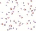 TCTN3 Antibody in Immunocytochemistry (ICC/IF)