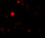 TCTN3 Antibody in Immunocytochemistry (ICC/IF)