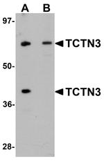 TCTN3 Antibody in Western Blot (WB)