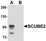 SCUBE2 Antibody in Western Blot (WB)