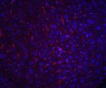 AFP Antibody in Immunohistochemistry (IHC)