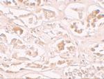 ALKBH2 Antibody in Immunohistochemistry (IHC)