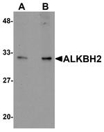 ALKBH2 Antibody in Western Blot (WB)