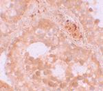 WDR92 Antibody in Immunohistochemistry (IHC)