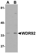 WDR92 Antibody in Western Blot (WB)