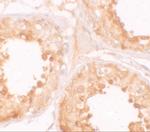 YBX2 Antibody in Immunohistochemistry (IHC)