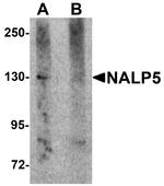 NALP5 Antibody in Western Blot (WB)