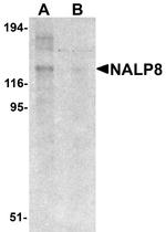 NALP8 Antibody in Western Blot (WB)