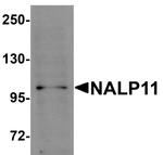 NALP11 Antibody in Western Blot (WB)