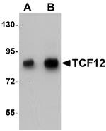 TCF12 Antibody in Western Blot (WB)