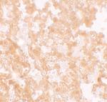 MFSD2A Antibody in Immunohistochemistry (IHC)