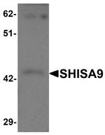 SHISA9 Antibody in Western Blot (WB)