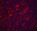 SYNPO Antibody in Immunohistochemistry (IHC)