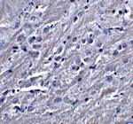 SYNPO Antibody in Immunohistochemistry (IHC)