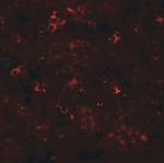 ZIP10 Antibody in Immunohistochemistry (IHC)