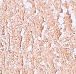 ZIP10 Antibody in Immunohistochemistry (IHC)