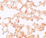 SLC39A6 Antibody in Immunohistochemistry (IHC)