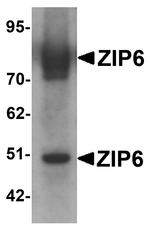 SLC39A6 Antibody in Western Blot (WB)