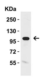 Klotho Antibody in Western Blot (WB)