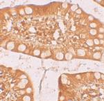 TFF3 Antibody in Immunohistochemistry (IHC)