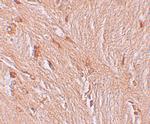 ZBTB3 Antibody in Immunohistochemistry (IHC)