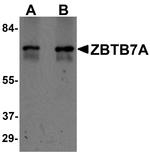 Pokemon Antibody in Western Blot (WB)