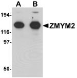 ZMYM2 Antibody in Western Blot (WB)