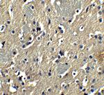 PION Antibody in Immunohistochemistry (IHC)